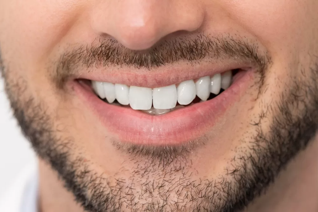 Tidying Teeth Without Orthodontics