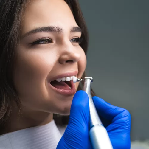 dental cleaning in north hollywood