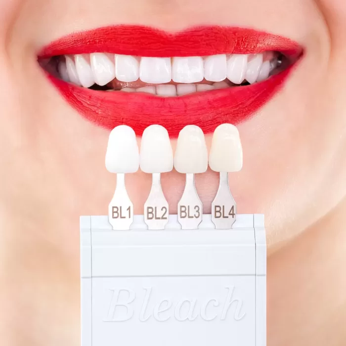 Cosmetic Dentistry- Porcelain Veneer shades in front of a nice smile