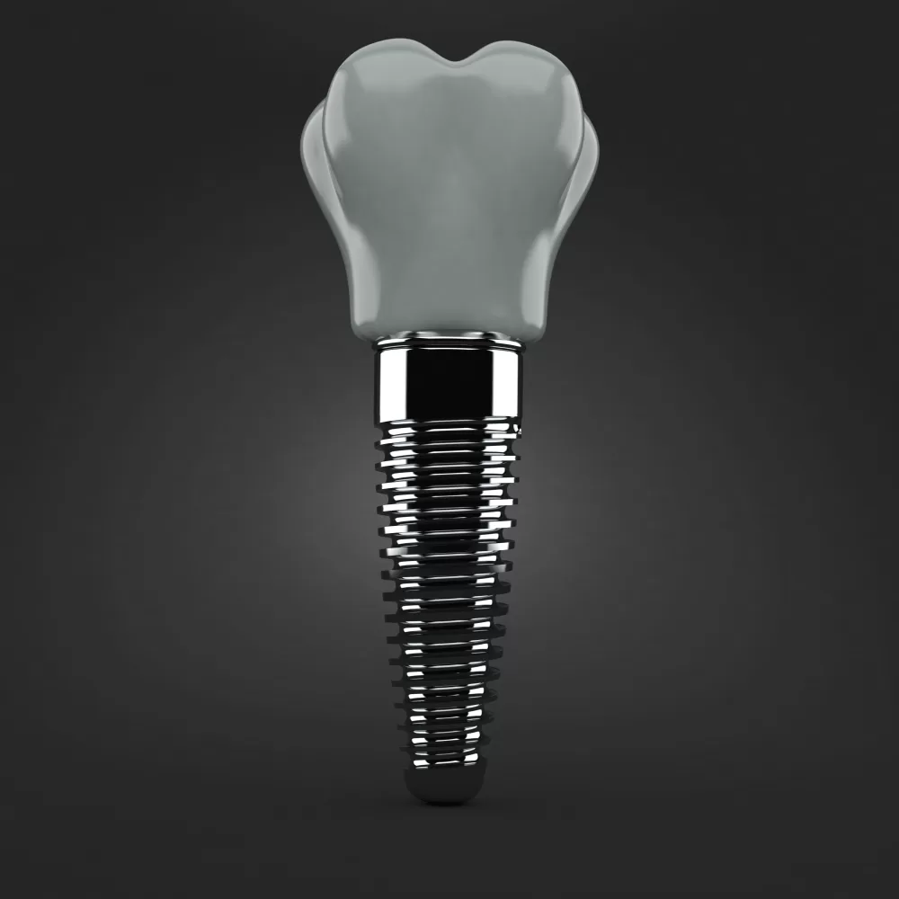 Dental,Implant,Isolated,On,Gray,Background.,3d,Illustration