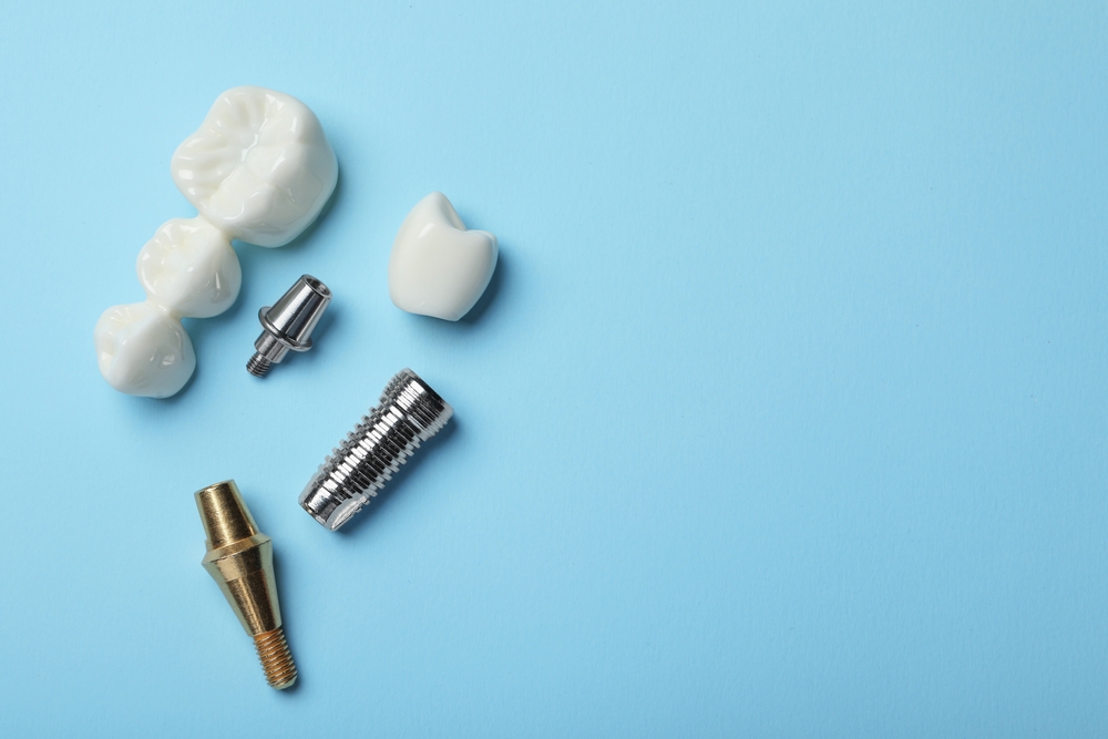 Dental implant post and crown components used at Toluca Advanced Dentistry North Hollywood