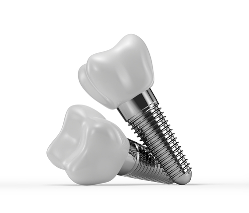 Dental,Implants,Isolated,On,A,White,Background.,3d,Rendering