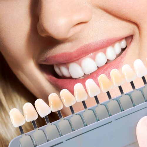 Toluca Lake Cosmetic Dentist