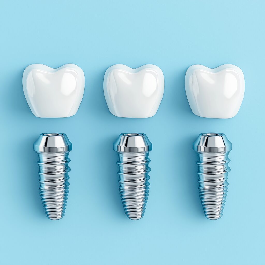 Dental Implants in north hollywood