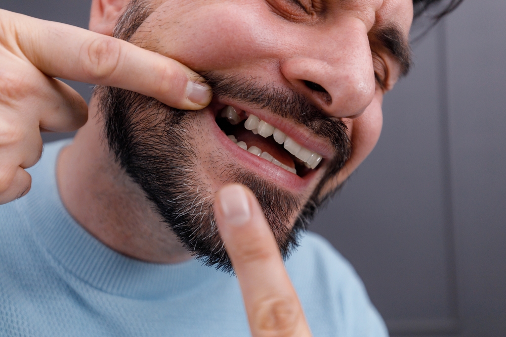 Man,Smiling,And,Playfully,Pointing,At,Missing,Tooth,With,Hands