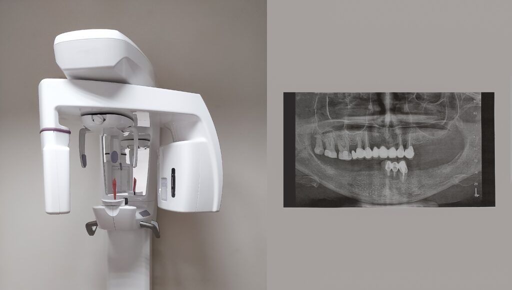 cone beam scan dental office in los angeles