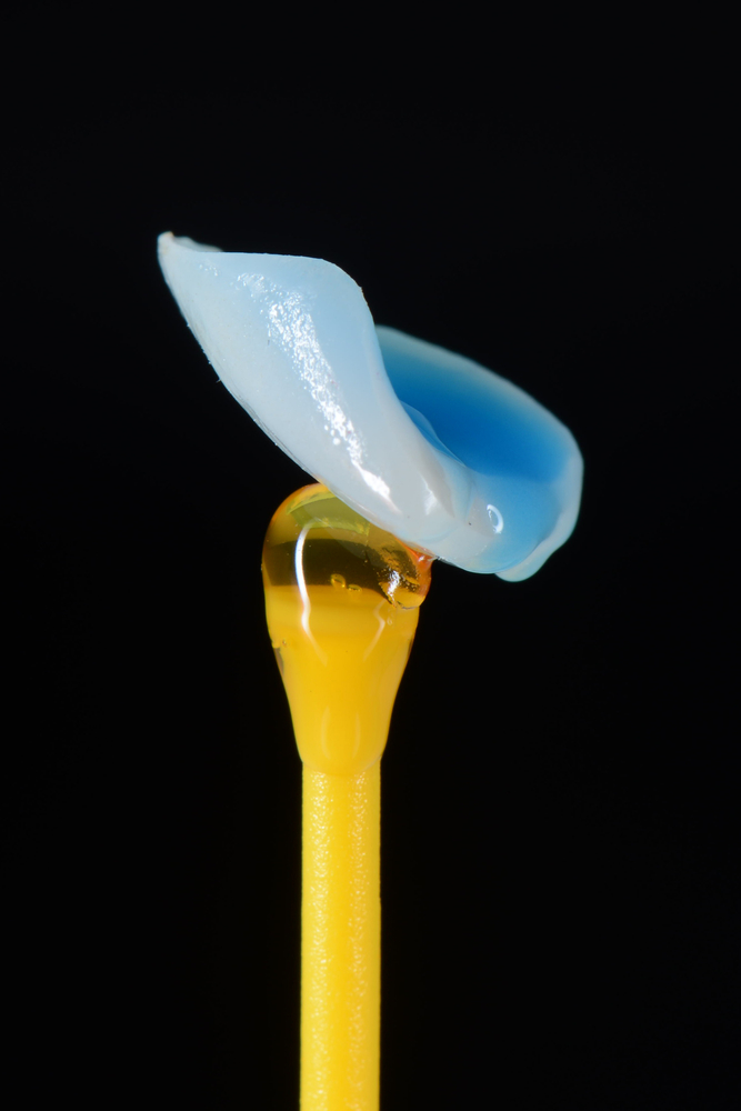 cosmetic bonding in north hollywood