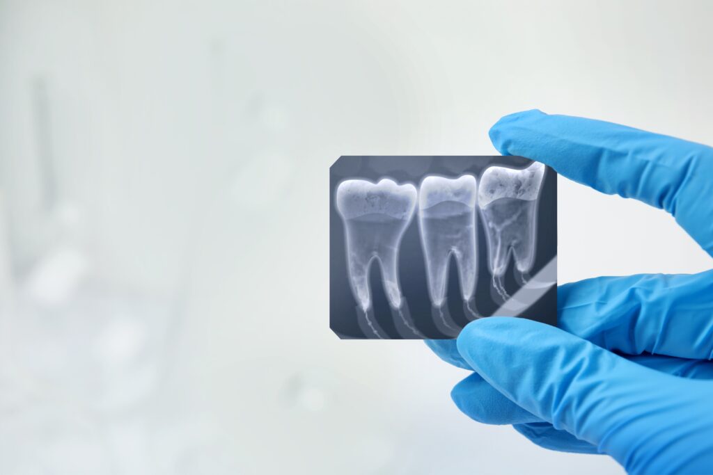 dentist holding x rays