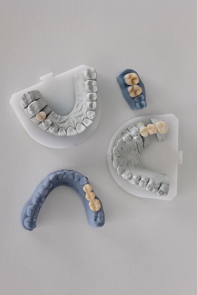 dental bridges #2