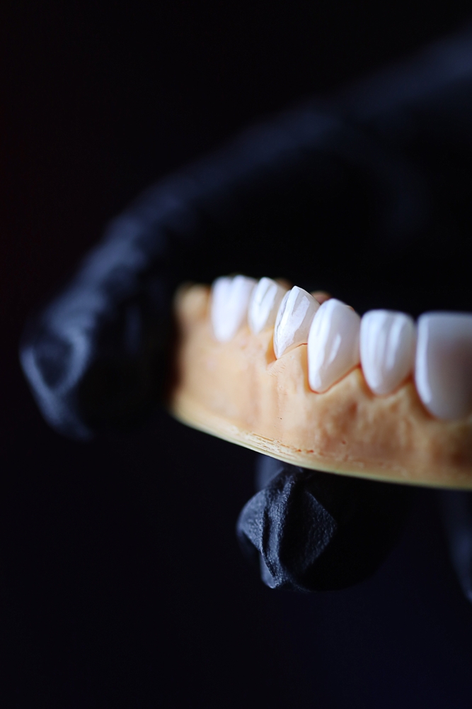 dental office offering payment plans for dental bridges and implants