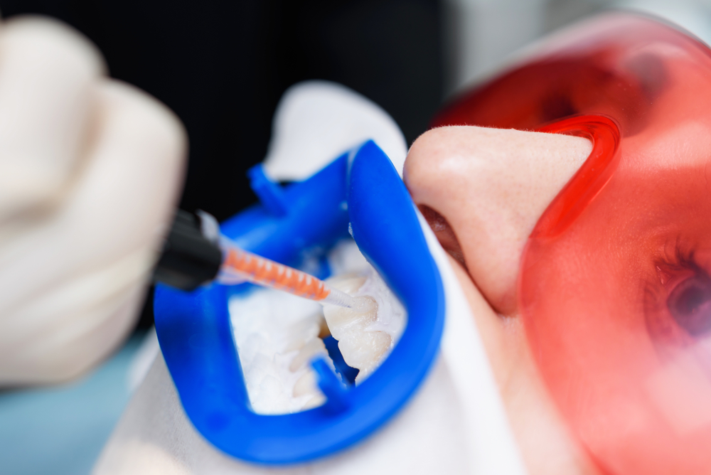 Patient receiving professional teeth whitening treatment at Toluca Advanced Dentistry in North Hollywood